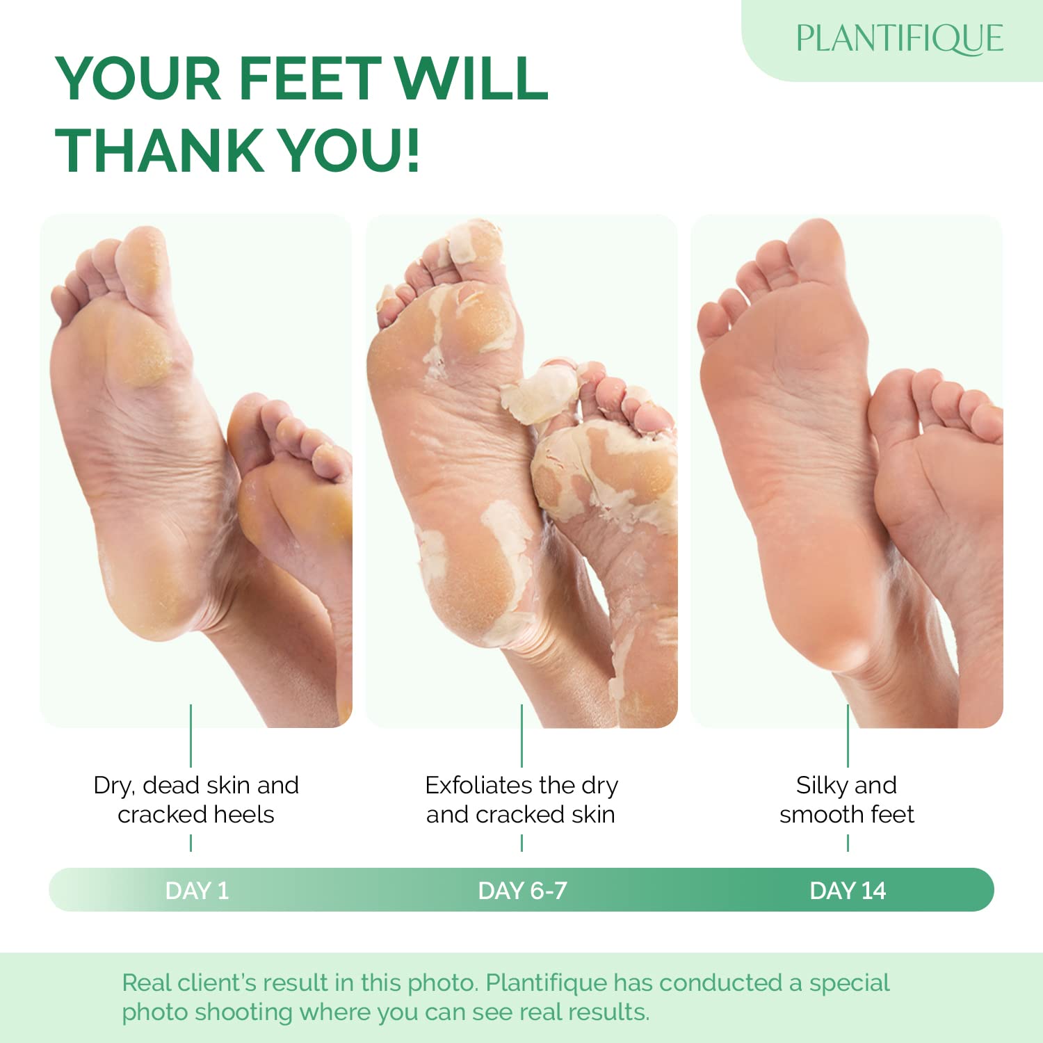 Plantifique Cosmety Paris Exfoliating Foot Peeling Mask for Soft Baby Feet - 2 Pairs - Removes Calluses, Dead and Dry Skin - Repairs Rough Heels In 7 Days; for Men and Women; Natural Gel Socks Booties